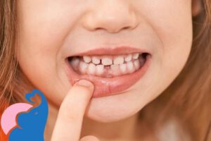 Wann verlieren Kinder ihre Milchzähne?