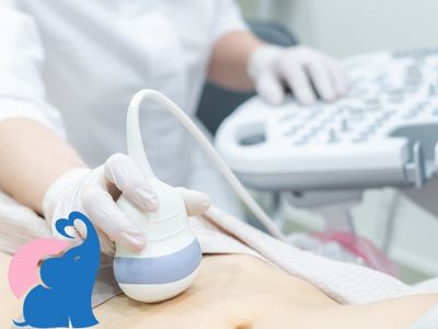 Schwanger wann allerspätestens zum Frauenarzt