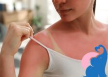 Ist Sonnenbrand in der Schwangerschaft gefährlich?