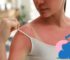 Ist Sonnenbrand in der Schwangerschaft gefährlich?